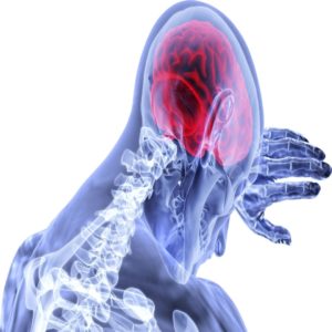 stroke treatment in rockville centre ny